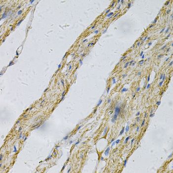 Immunohistochemistry - PRNP Antibody (144-02583)
