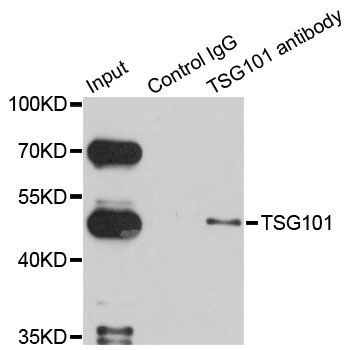 Immunoprecipitation - 3ug TSG101 antibody (144-61333)