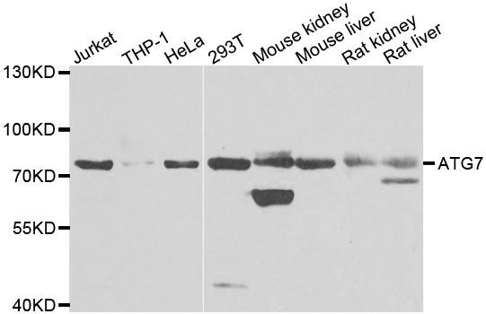 Western blot - ATG7 Polyclonal Antibody (144-00691)