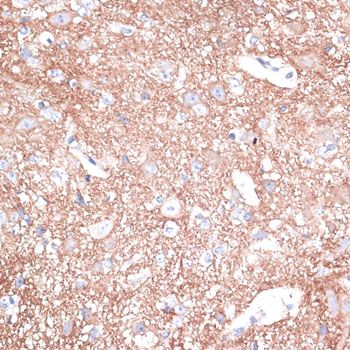 Immunohistochemistry - STXBP1 Polyclonal Antibody (144-05420)
