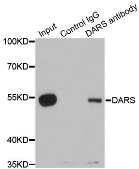 Immunohistochemistry - DARS Polyclonal Antibody (144-06574)