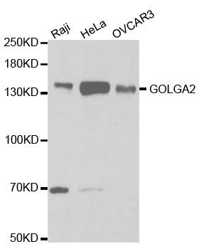 Western blot - GOLGA2 Polyclonal Antibody (144-05344)
