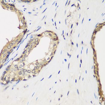 Immunohistochemistry - METTL7A antibody (144-08201)