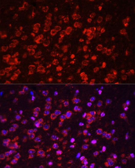 Immunofluorescence - STAT3 Polyclonal Antibody (144-01192)