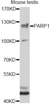 Western blot - PARP1 Polyclonal Antibody (144-60002)