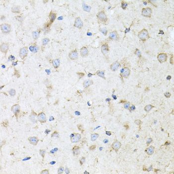 Immunohistochemistry - KLK11 antibody (144-06641)