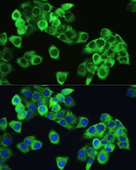 Immunofluorescence - Phospho-mTOR-S2448 pAb (144-50094)