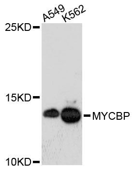 Western blot - MYCBP antibody (144-61391)