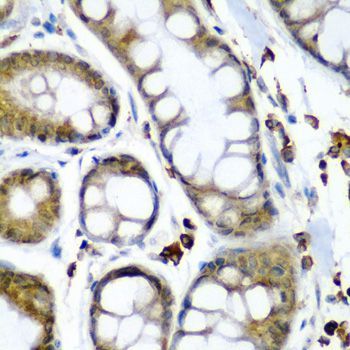 Immunohistochemistry - SECISBP2 Polyclonal Antibody (144-06736)