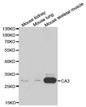 Western blot - CA3 antibody (144-01212)