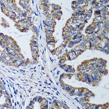 Immunohistochemistry - ATP5B Polyclonal Antibody (144-05769)