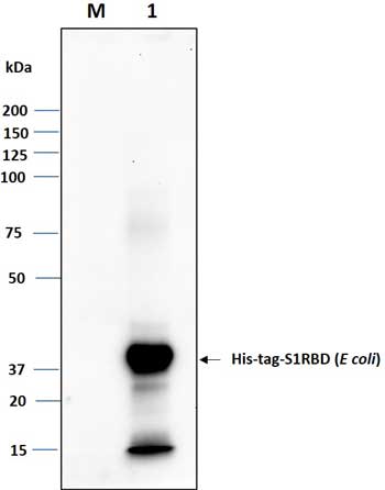 Western blot image