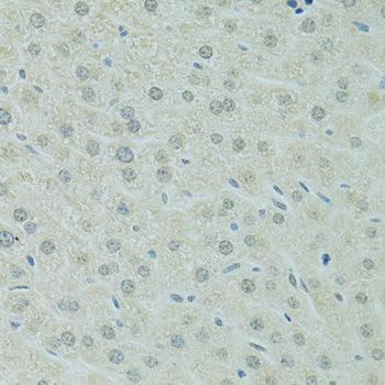 Immunohistochemistry - RCC1 Polyclonal Antibody (144-06350)