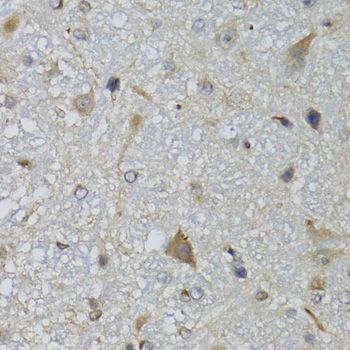 Immunohistochemistry - CHN1 antibody (144-07546)