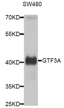 Western blot - GTF3A antibody (144-08426)