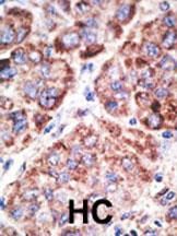 IHC-P