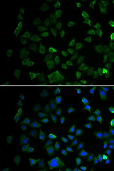 Immunofluorescence - MAP2K1 Polyclonal Antibody (144-00252)