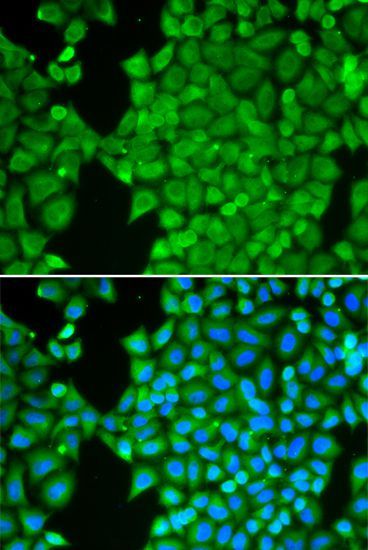 Immunofluorescence - CA3 antibody (144-60352)
