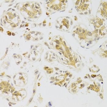 Immunohistochemistry - CASP2 Antibody (144-05724)