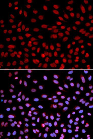 Immunofluorescence - POLH Polyclonal Antibody (144-01833)