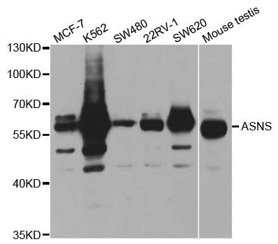 Western blot - ASNS antibody (144-05558)