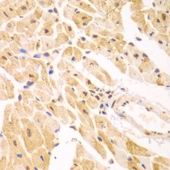 Immunohistochemistry - PSMD2 antibody (144-01999)