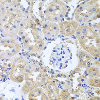 Immunohistochemistry - ITPKB antibody (144-03929)