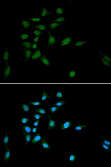 Immunofluorescence - PSMA1 Polyclonal Antibody (144-02523)