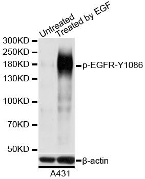 Western blot - Phospho-EGFR-Y1086 pAb (144-61536)