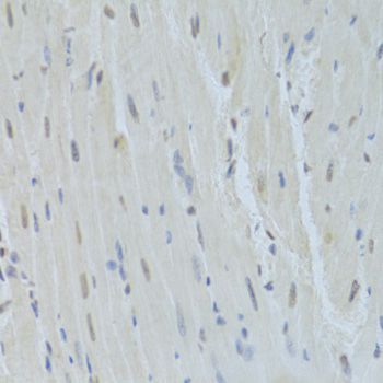 Immunohistochemistry - HNRNPK Antibody (144-01701)