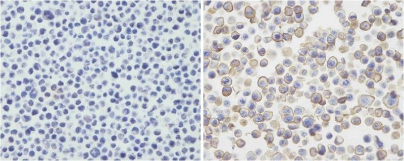 IHC-P