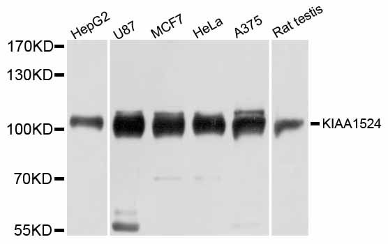 Western blot - KIAA1524 antibody (144-012267)