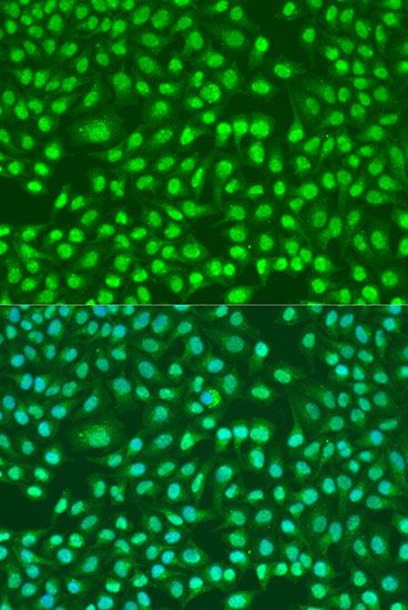 Immunofluorescence - PSEN2 Polyclonal Antibody (144-07719)