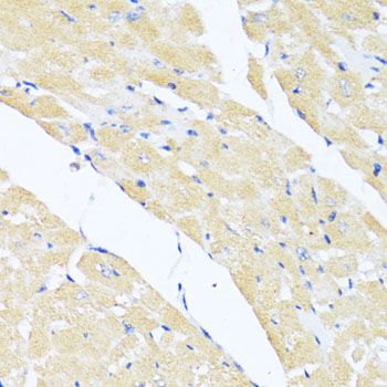 Immunohistochemistry - EIF2S1 Polyclonal Antibody (144-00764)