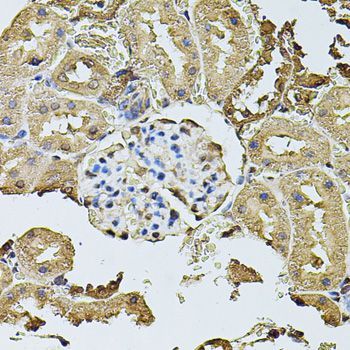 Immunohistochemistry - CDH6 antibody (144-08109)