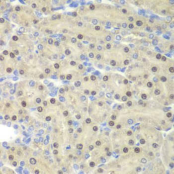 Immunohistochemistry - ELF3 antibody (144-06371)