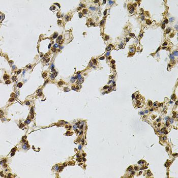 Immunohistochemistry - IFI16 Antibody (144-60546)