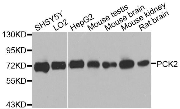 Western blot - PCK2 Polyclonal Antibody (144-08446)