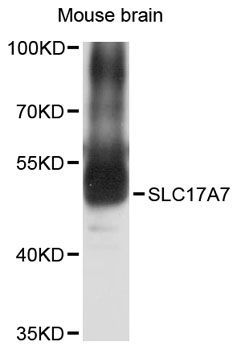 Western blot - SLC17A7 antibody (144-012879)