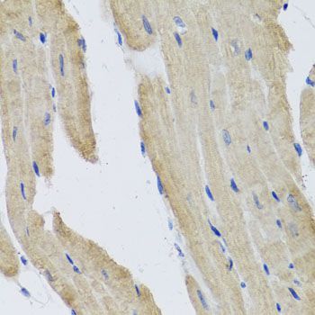 Immunohistochemistry - PRPH antibody (144-04048)