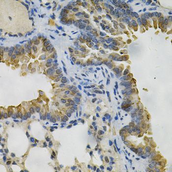 Immunohistochemistry - AKR1B1 Antibody (144-60529)