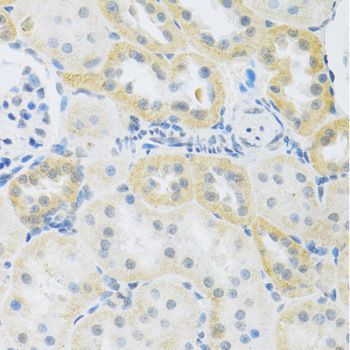 Immunohistochemistry - SLC39A7 antibody (144-03343)