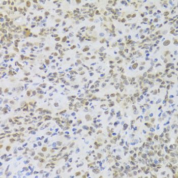 Immunohistochemistry - HMGB1 Polyclonal Antibody (144-02553)