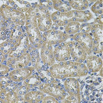 Immunohistochemistry - DNAJA3 Polyclonal Antibody (144-07030)