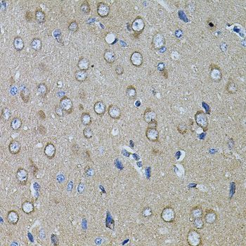 Immunohistochemistry - CHRFAM7A antibody (144-07844)