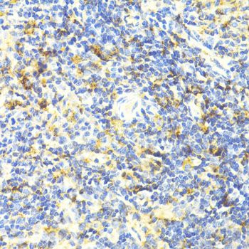 Immunohistochemistry - ARRB1 Polyclonal Antibody (144-00998)