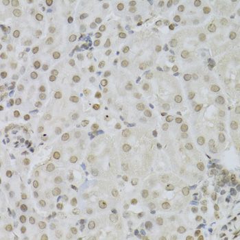 Immunohistochemistry - MAPK3 Polyclonal Antibody (144-00228)