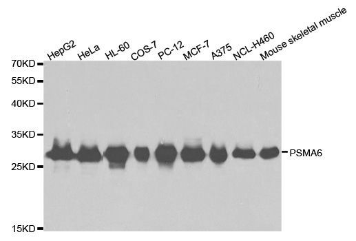 Western blot - PSMA6 antibody (144-02188)