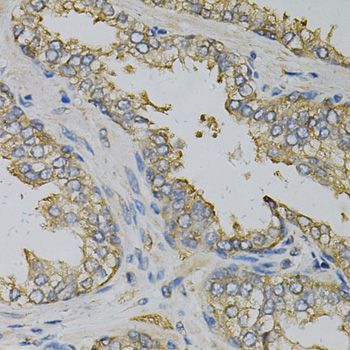 Immunohistochemistry - EIF4B Polyclonal Antibody (144-05405)