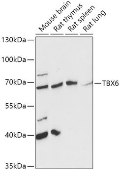 Western blot